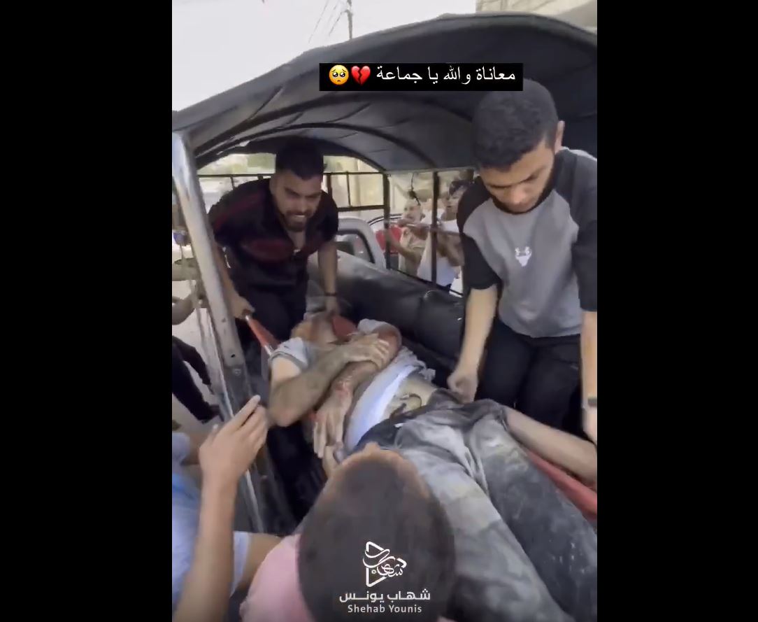 Video: After Israeli genocide last night, this is how wounded Gazans being transported to hospital
