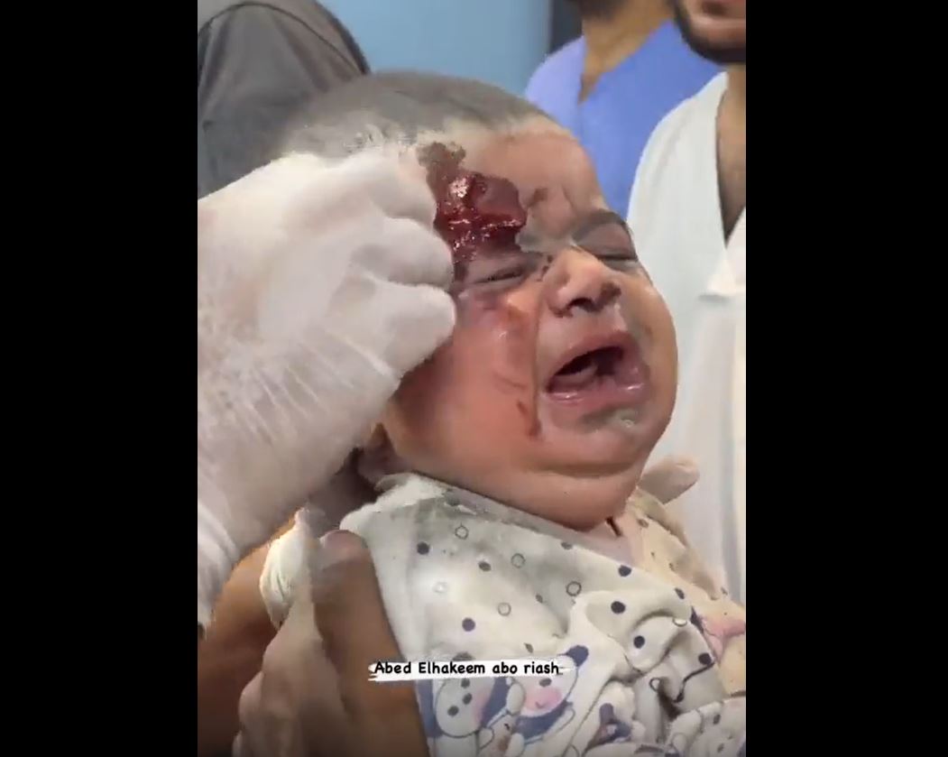 Video: Innocent kids remain a number-one target of ongoing Israeli genocide Gaza