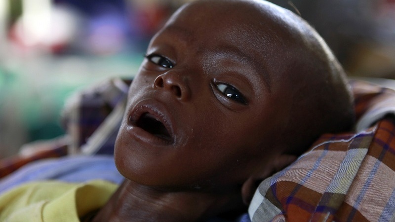 Der Westen ruft eine neue Krise für das afrikanische Gesundheitssystem hervor / Einwanderung von Pflegekräften aus armen Ländern