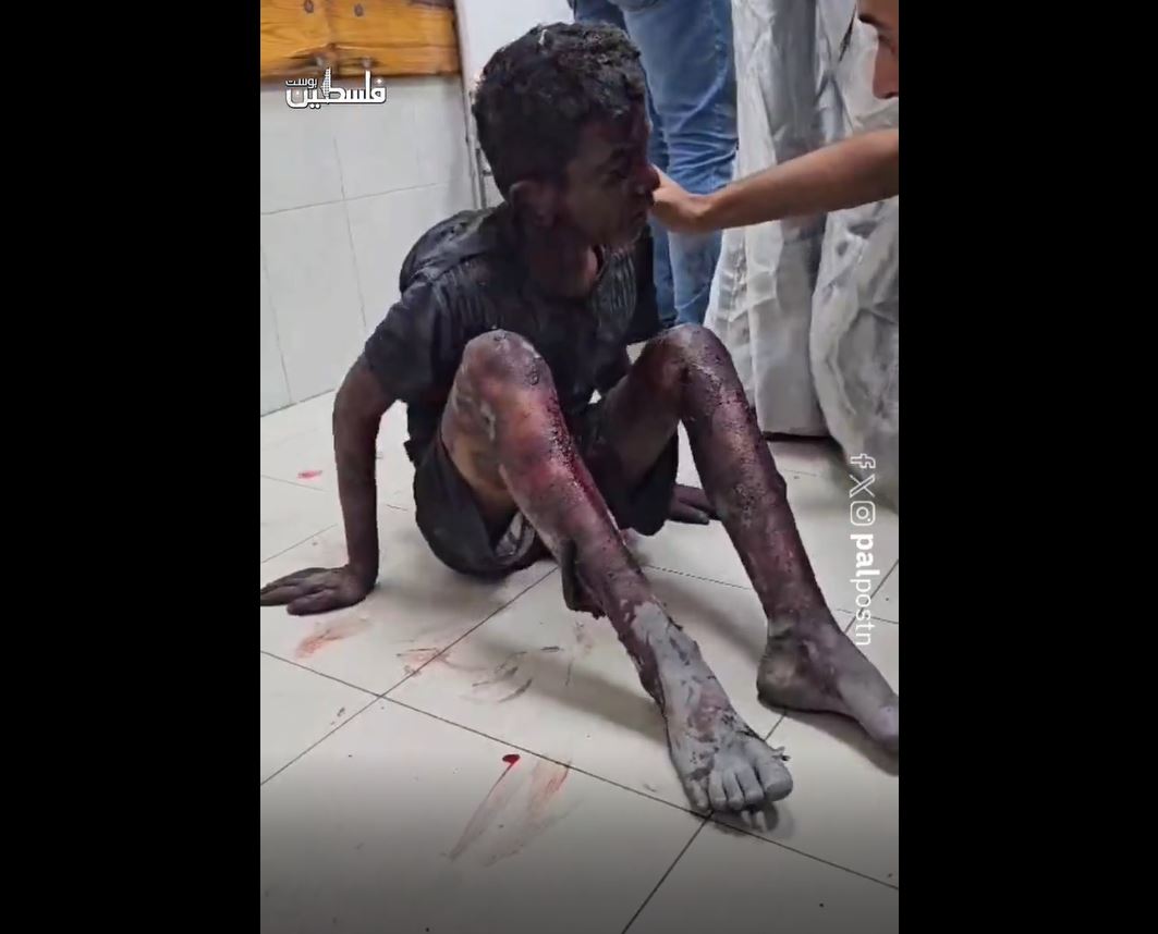Video: The bleeding wound; Gaza