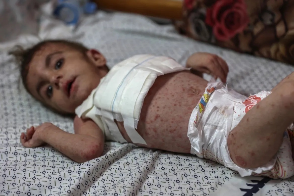 US-backed Israeli genocide in Gaza enters day 301