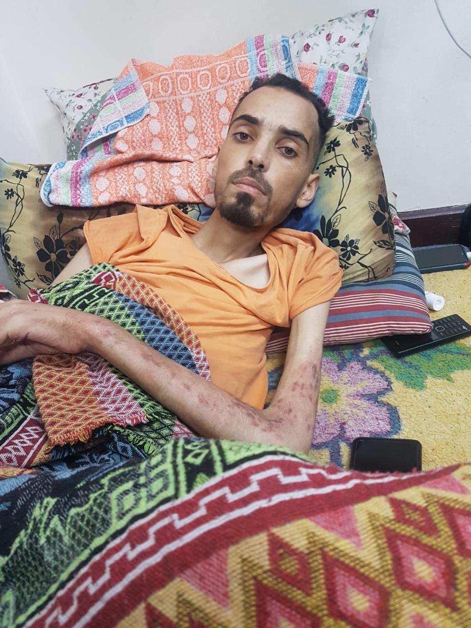 Euro-Med: A growing number of sick and injured people are dying due to Israeli blockade