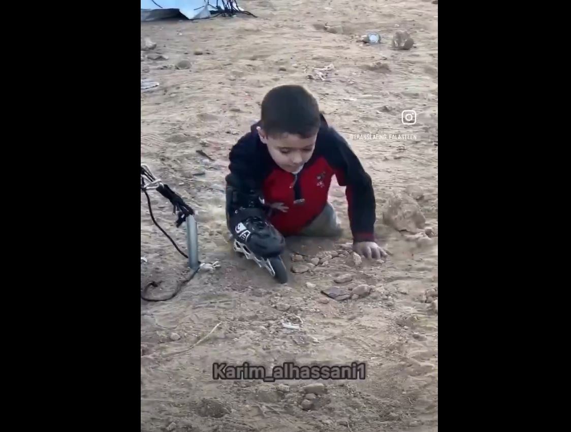 Video: A Palestinian boy in Gaza with both legs amputated, resorts to using rollerskates to navigate 