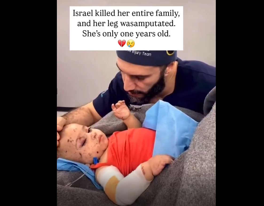 Video: Israel martyred entire family of this Palestinian girl, and her leg also amputated