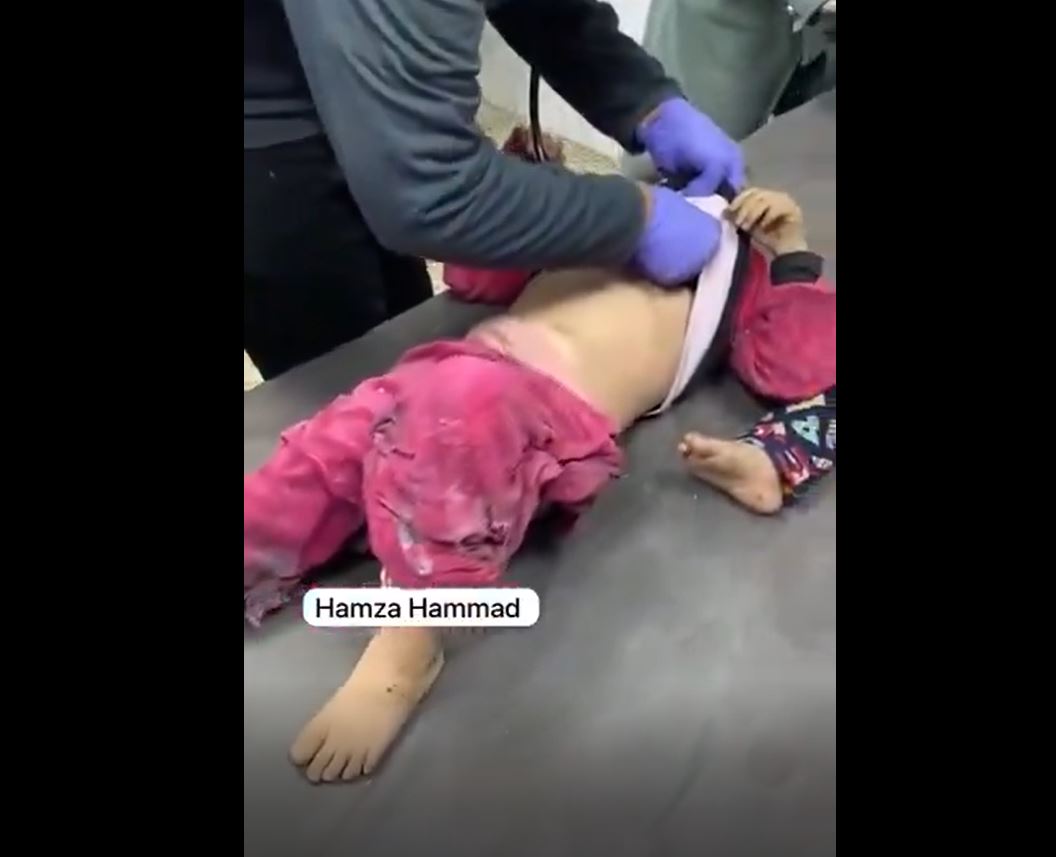 Video: Injuries among Palestinian children by Israeli occupation airstrike in Jabalia, northern Gaza