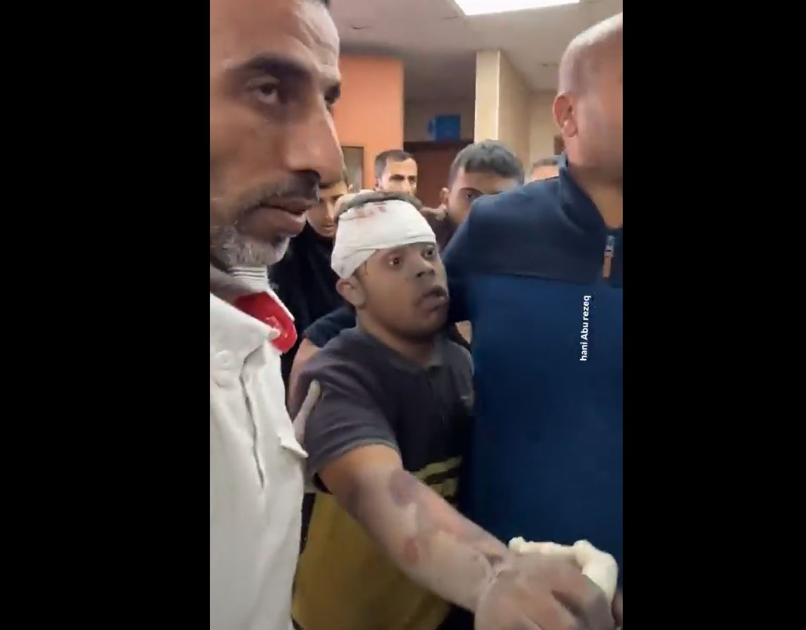 Video: A Palestinian boy with special needs, injured in Israeli airstrike in Bureij, central Gaza 