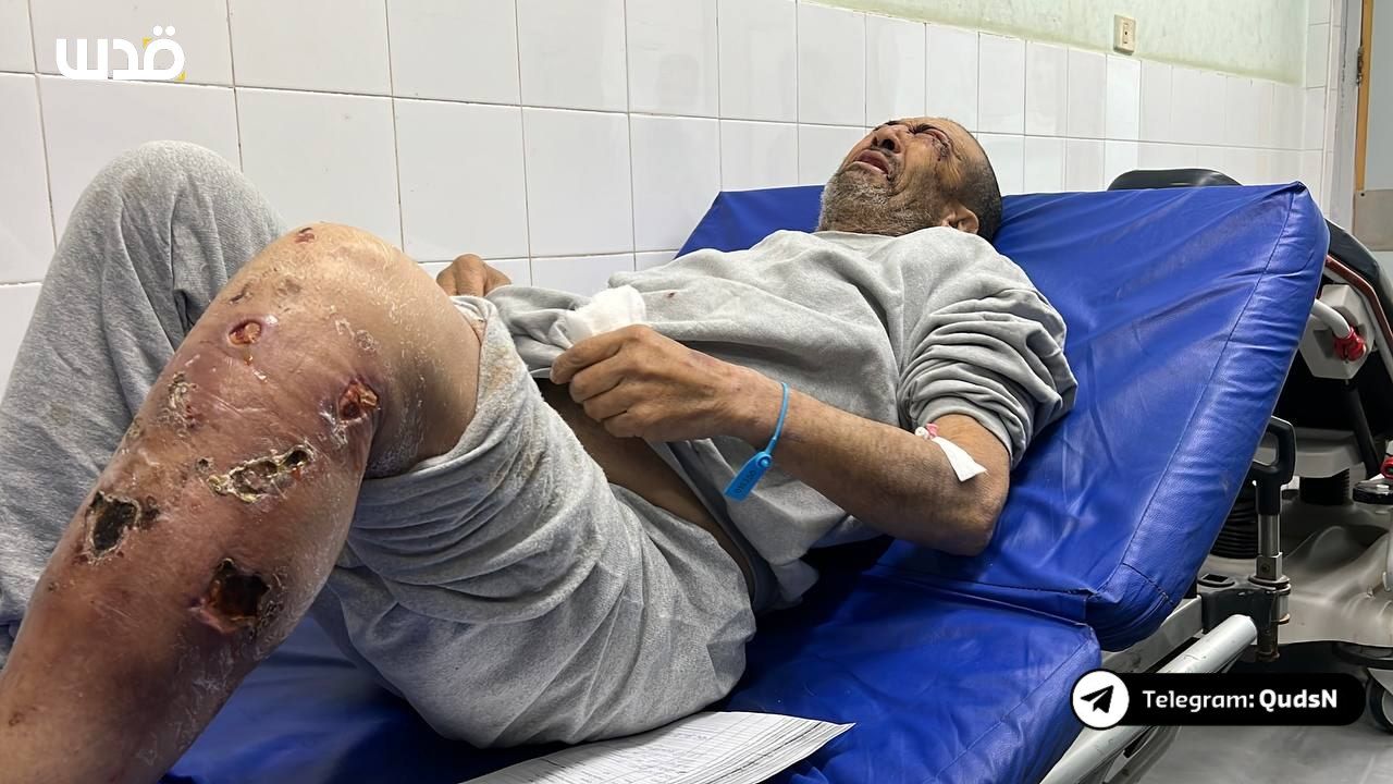 Israeli occupation forces releases 25 Gazan prisoners in very bad shape