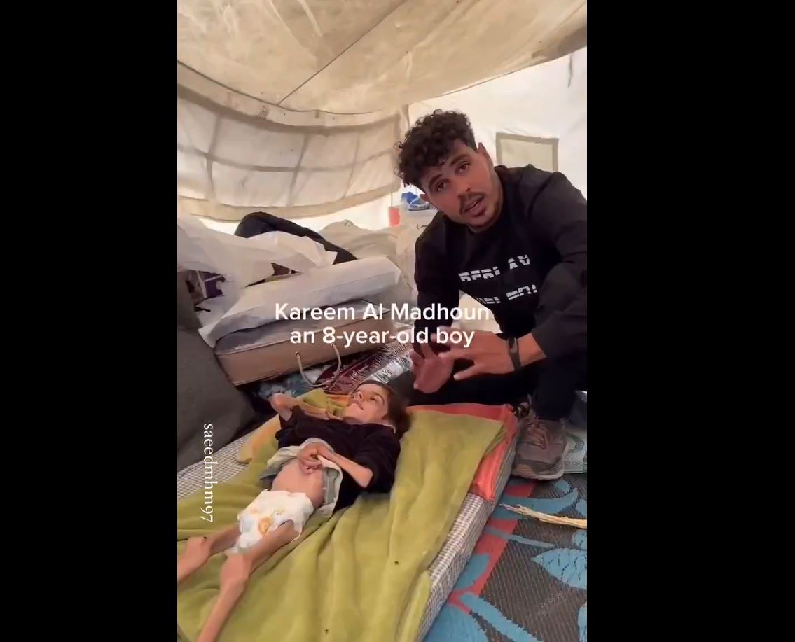 Video: Palestinian child, suffers body atrophy, cerebral palsy... due inhumane Israeli blockade of Gaza