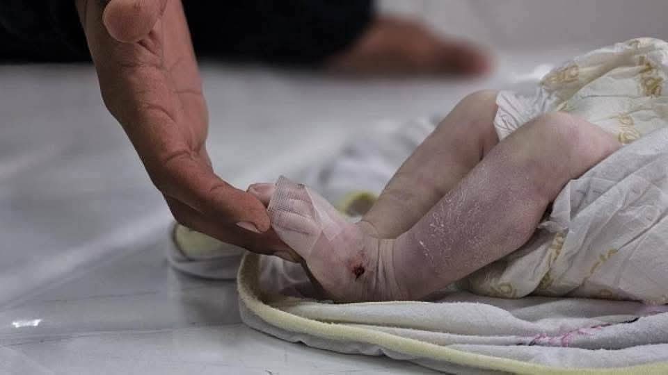 30 Palestinian martyrs, 99 wounded in Israeli massacres in Gaza in past 24 hours