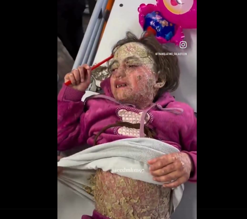 Sensitive video: 6-year-old Palestinian girl suffers from an unknown skin disease invaded her body