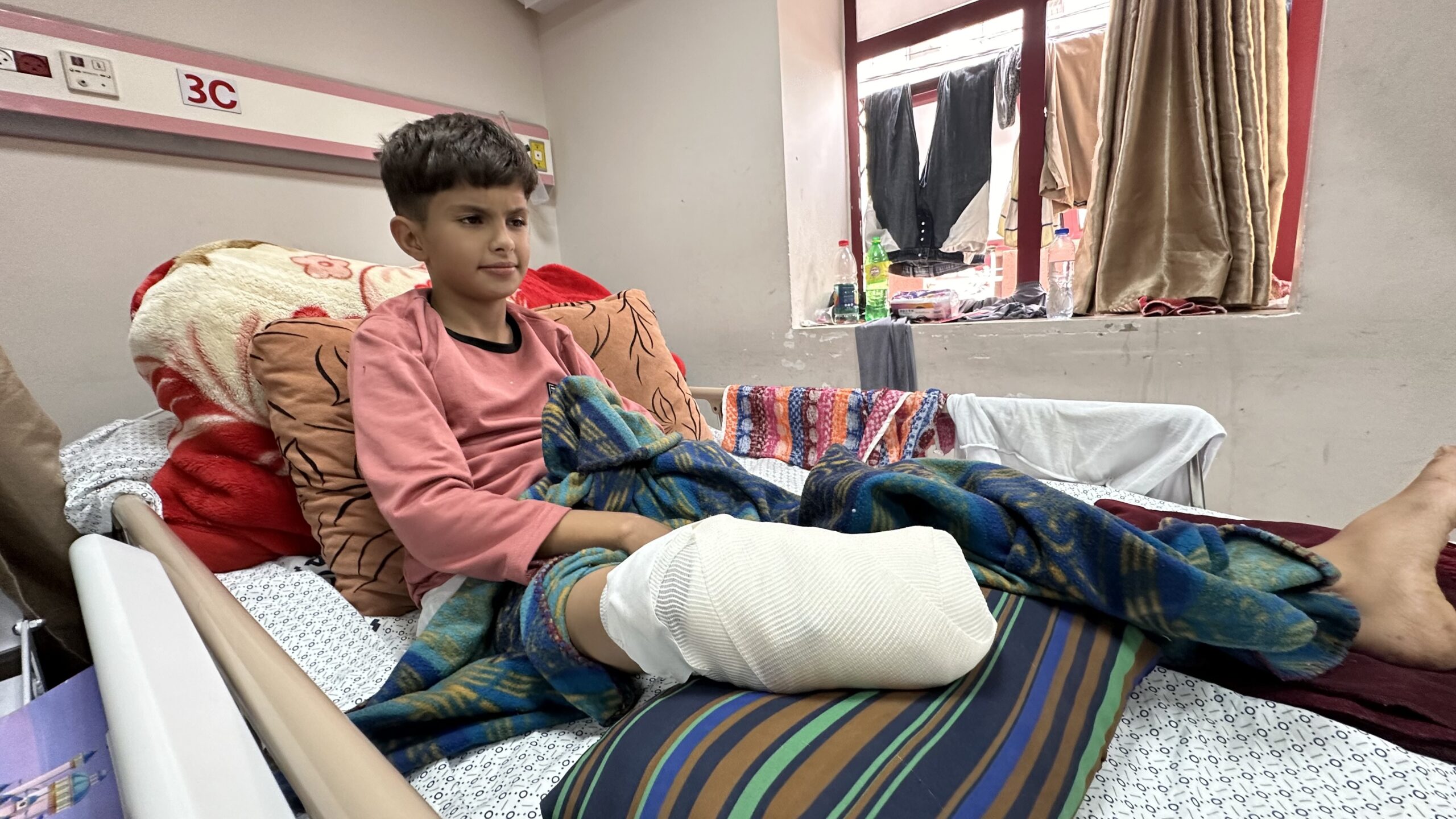 UN Committee: More than 10 children in Gaza lose their legs every day