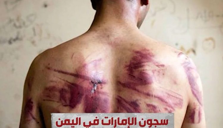  Media platform publishes report on Emirati prisons where abducted Yemenis are taken
