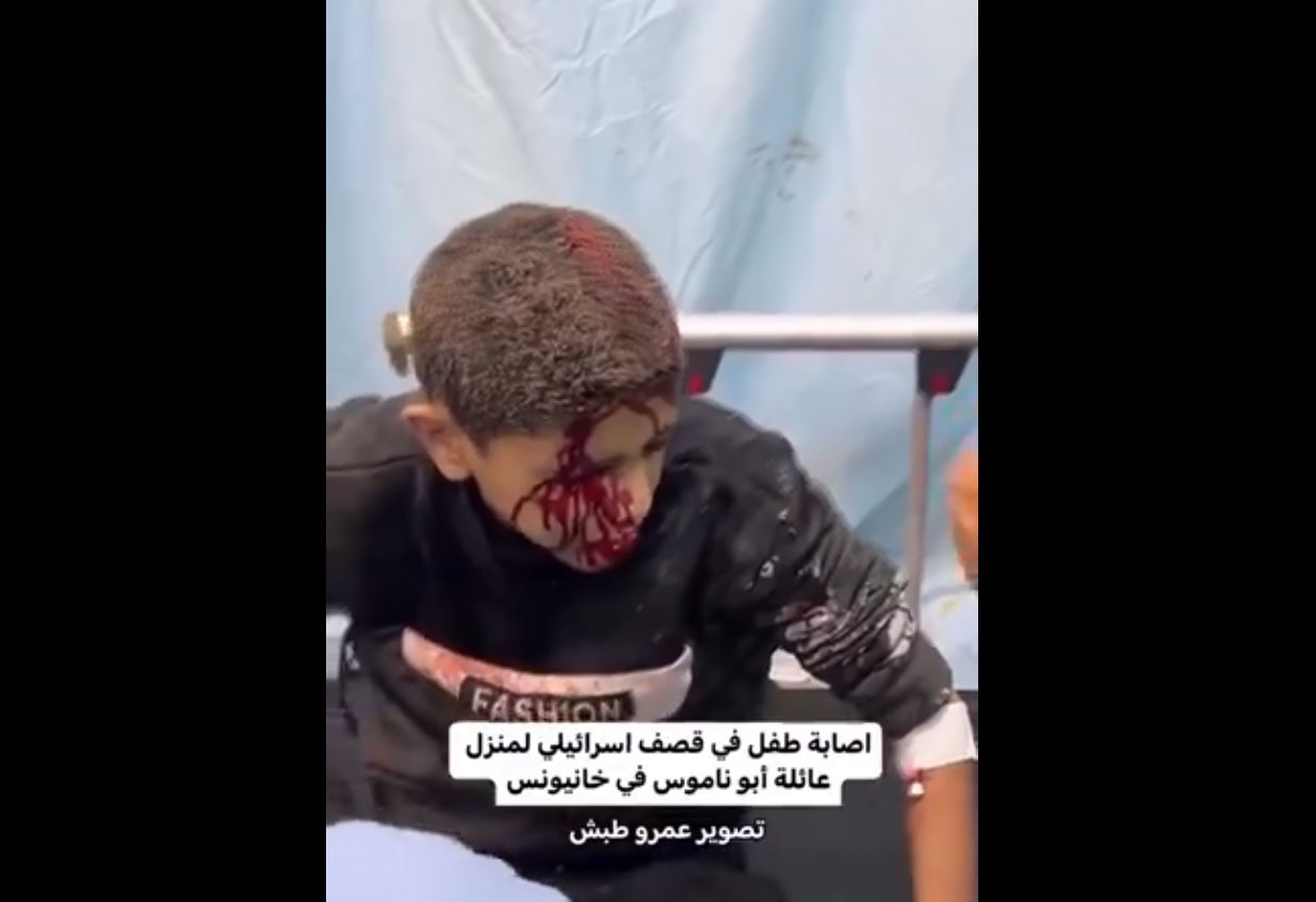 Video: Palestinian children injured in Israeli air strike that bombed a home in Khan Younis 