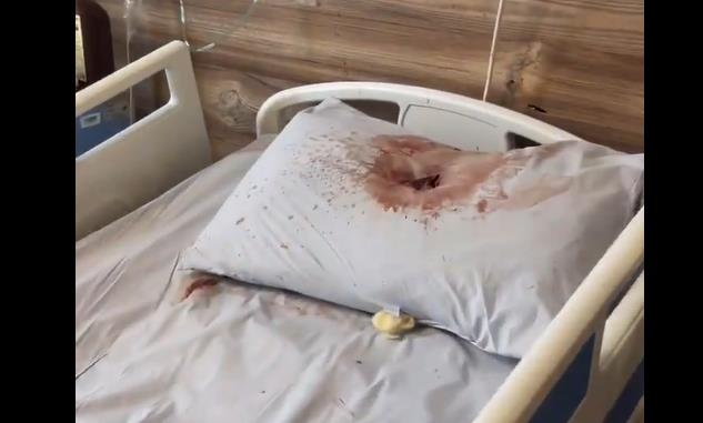 فيديو |غرفة المستشفى التي أعدمت قوة صهيونية فيها ثلاثة فلسطينيين في جنين
