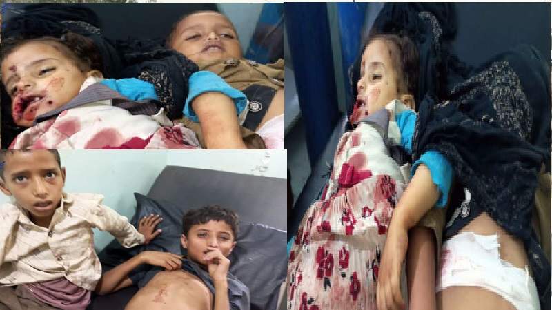  8 شهداء وجرحى جلهم من الأطفال في جريمة جديدة لمرتزقة العدوان بمحافظة تعز