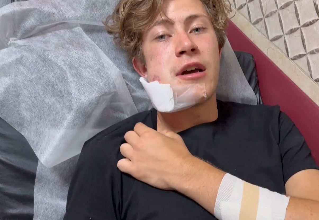  Israeli settlers attack, beat up foreign volunteers helping Palestinians in West Bank 