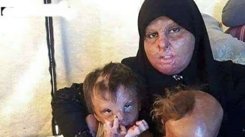 Pembakaran Perempuan dan Warga Sipil oleh Israel, Meneladani Pembantaian AS di Jepang