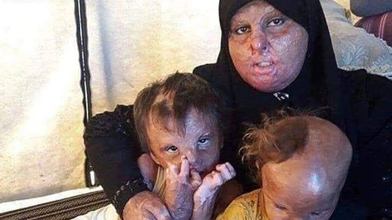 Сожжение Израилем палестинских мирных жителей – модель, взятая у американских убийств в Японии