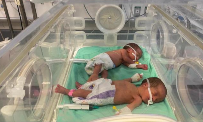 Resulta ng malnutrisyon at dehydration, 15 bata ang namatay sa Kamal Adwan Hospital sa hilagang Gaza Strip