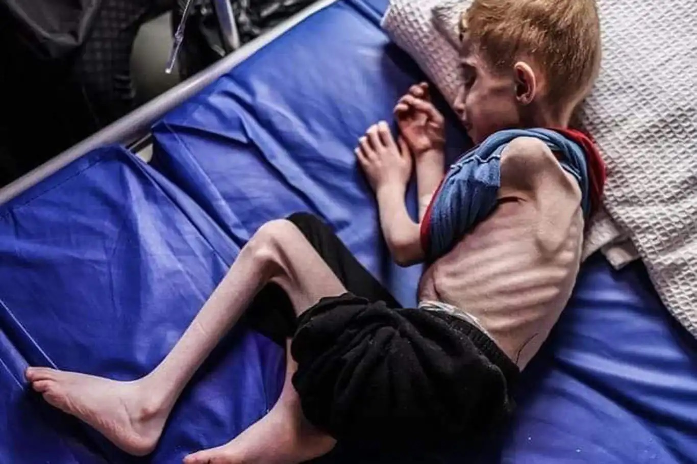Israeli closure of Rafah crossing worsens humanitarian crisis, threatens famine
