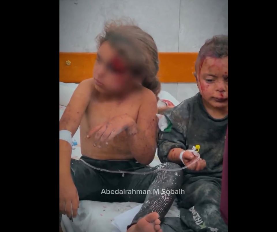 Video: Innocent Palestinian children injured in an Israeli airstrike in Gaza City