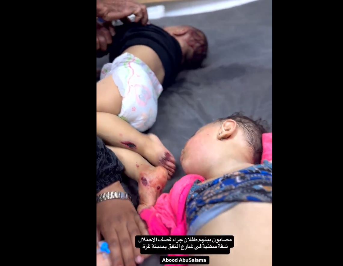 Sensitive Video: Severe injuries, including children, as a result of Israeli occupation bombing in Al-Nafaq, Gaza 