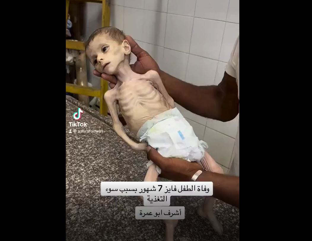 Video: Seven-month-old Palestinian infant martyred due to malnutrition 