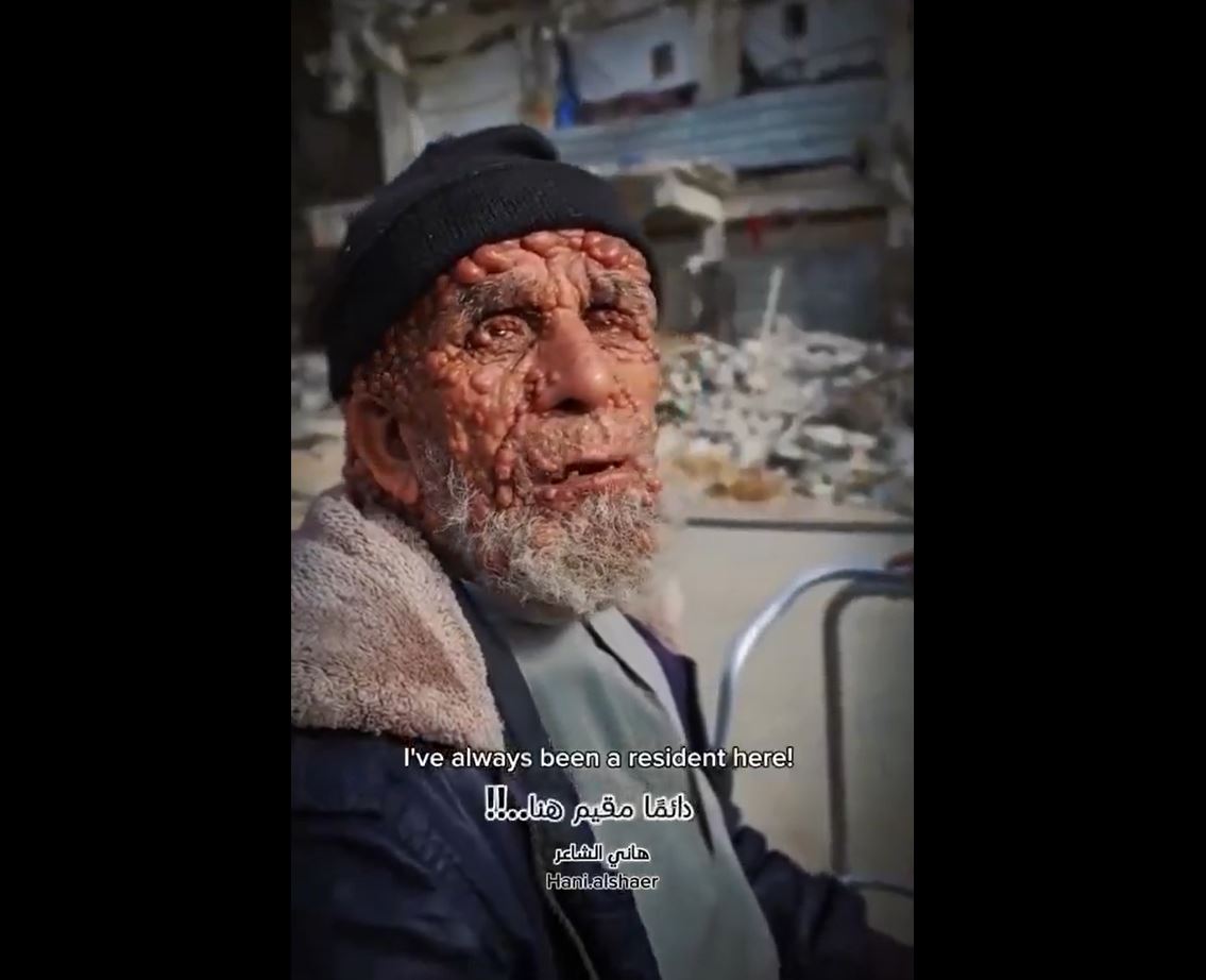 Video: Palestinian civilians in danger of epidemics which spreading in light of collapse of health system in Gaza