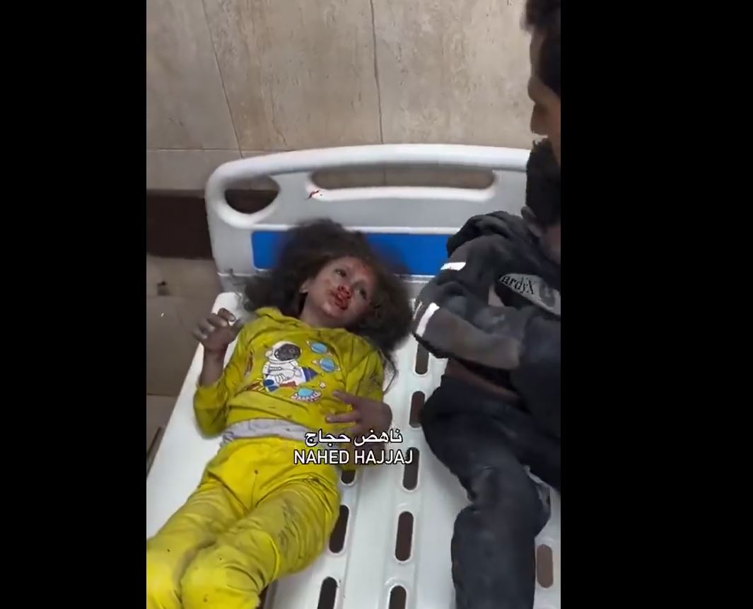 Video: Palestinian children injured in occupation's bombing of a house in Al-Bureij, central Gaza 