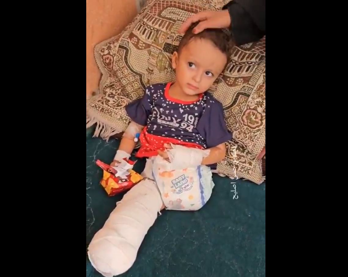 Video: Gaza become home to largest group of amputee children in modern history