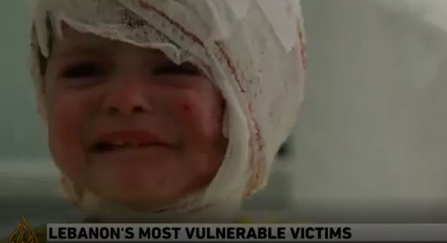 Video: 2-year-old Lebanese girl sustained third degree burns when Israeli airstrike hit her home 