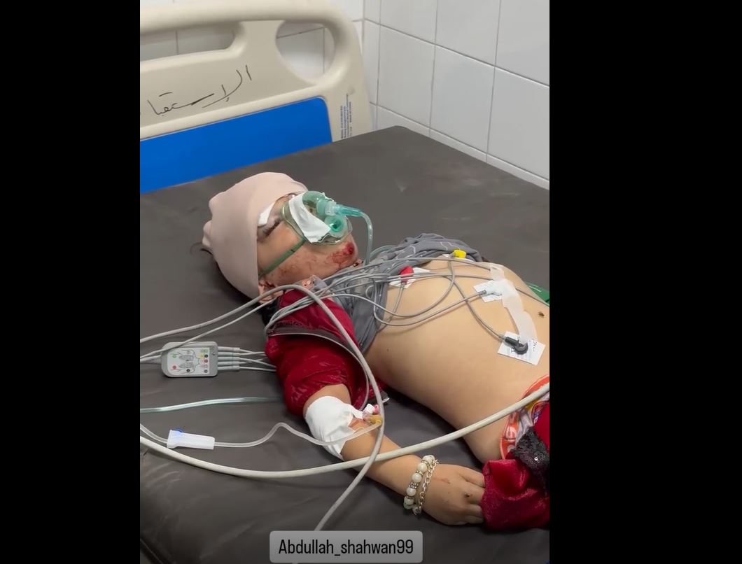 Video: A Palestinian child martyred after bombs dropped from Israeli Quadcopter in Sheikh Radwan, Gaza 