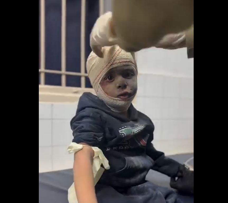 Video: Injuries among children due to relentless Israeli airstrikes in Al-Tuffah, eastern Gaza 