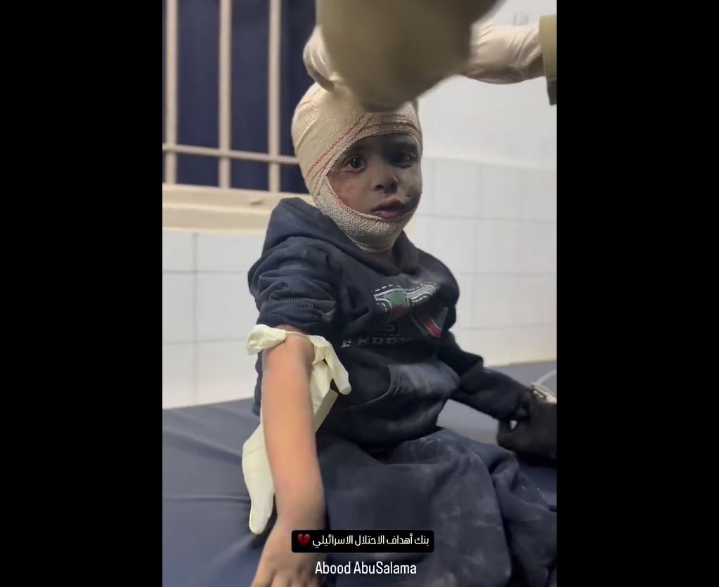 Video: Palestinian children injured in Israeli barbaric air attacks on Gaza Strip