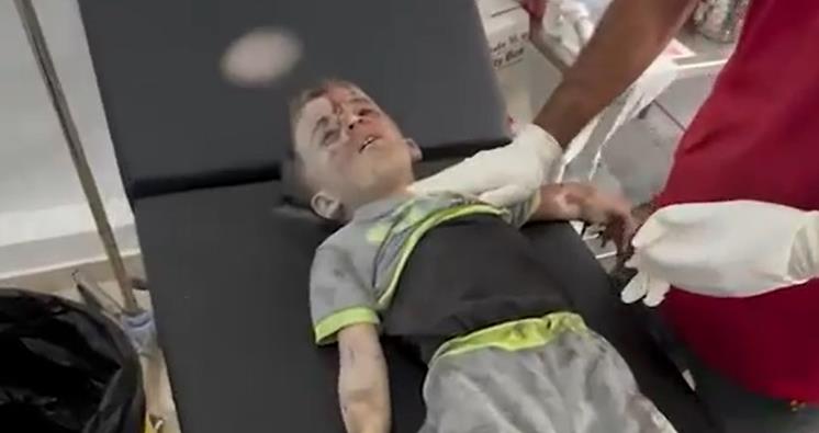 أطباء متطوعون: الاحتلال الصهيوني يستهدفون الأطفال في الرأس بغزة