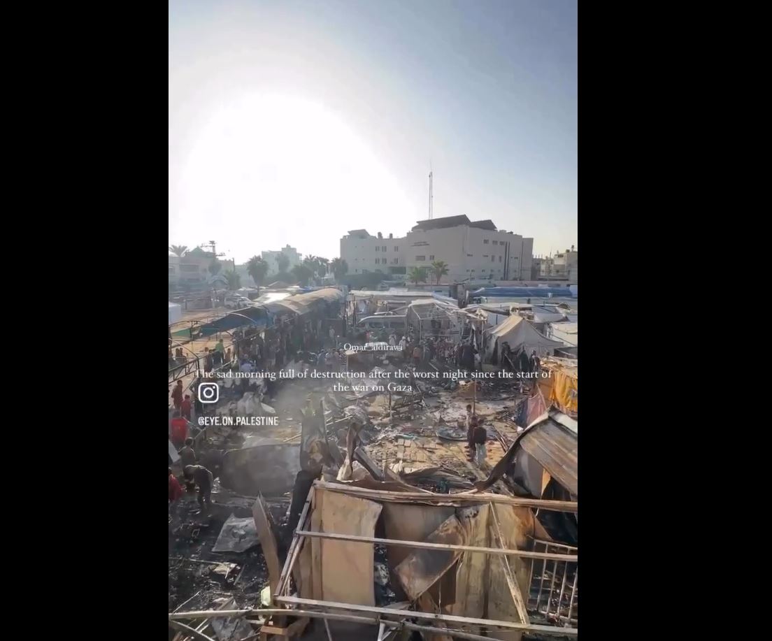 Video: Condition of Palestinian tents in Al-Aqsa Hospital in Gaza after burned by Zionists last night