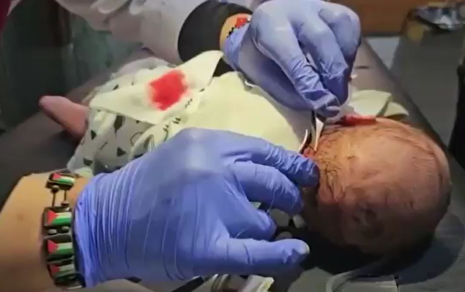 Video: Palestinian infant born today gets wounded by Israeli airstrike on same day in northern Gaza