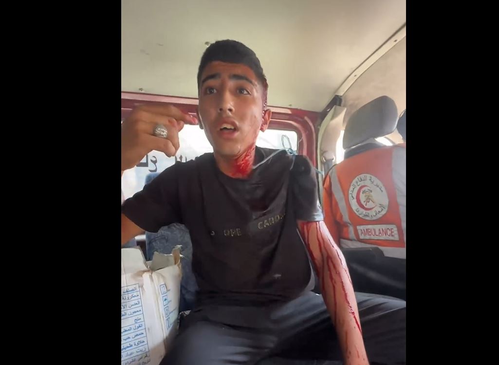Video: A Palestinian child lost ability to speak after injured in Israeli bombing of Jabalia, Gaza