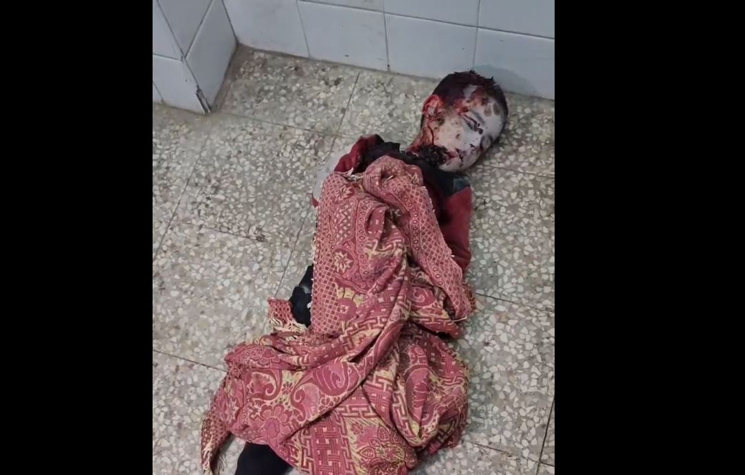 Sensitive Video: Two children martyred, many injured in Israeli air attack in Central Gaza 