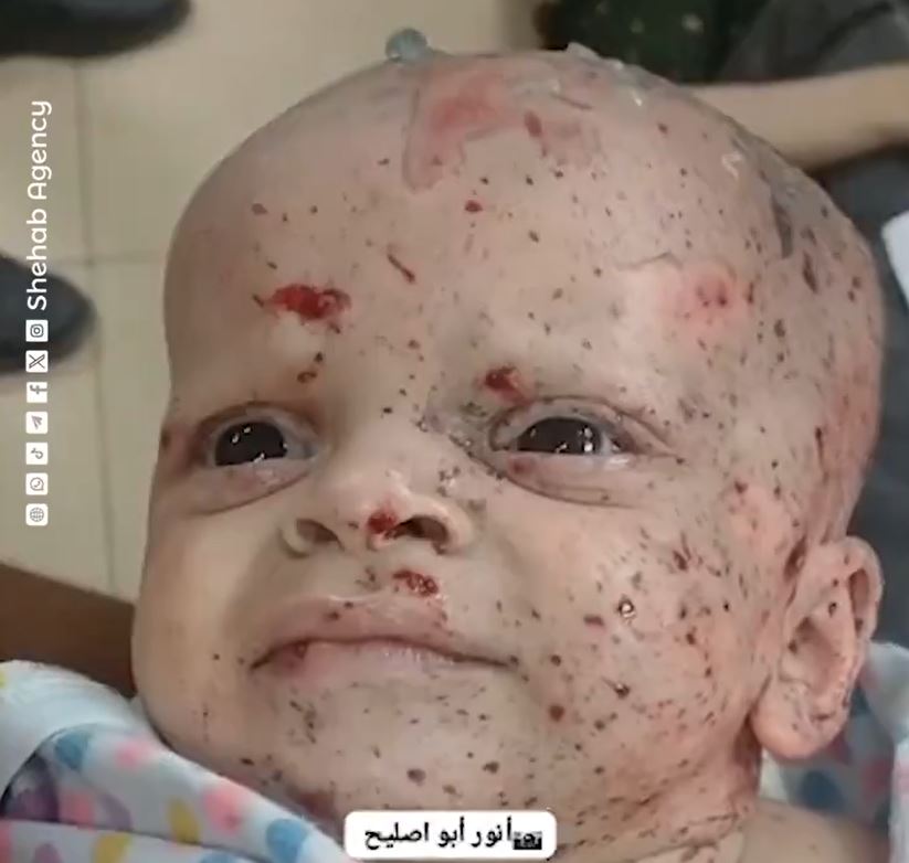 Sensitive Video: Look at what Israel is doing to Palestinian babies...