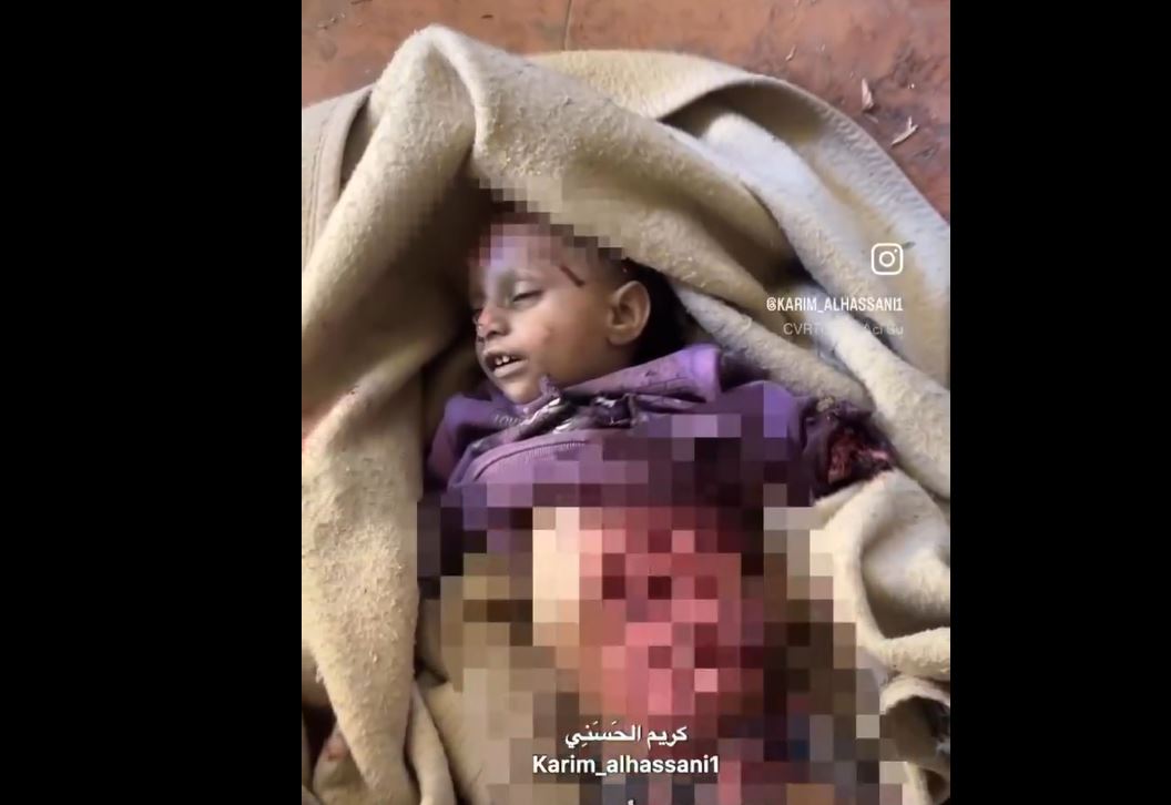 Sensitive Video:  Palestinian child girl taking her last breath following Israeli airstrike in Northern Gaza