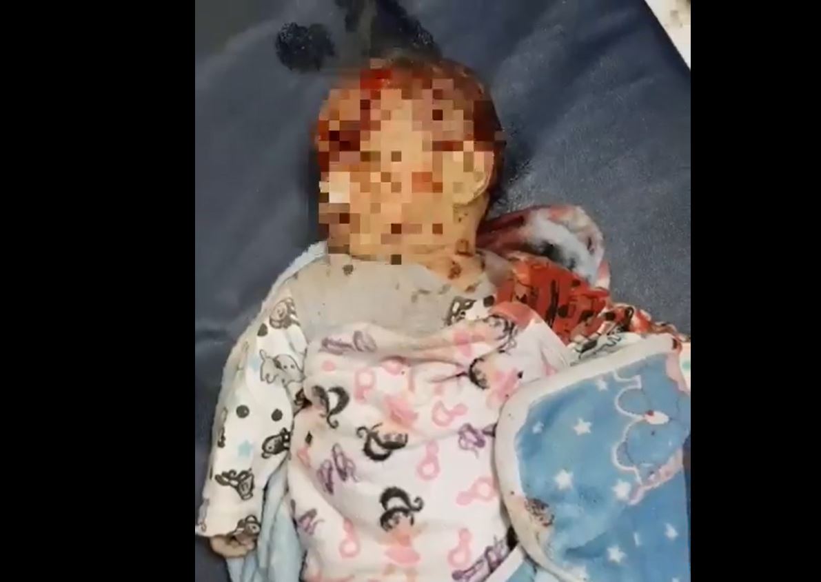 Vîdîyoya: Pitika (Zaroka) Filistînî ya ji Cebalîyê di dema qirkirinê de ji dayik bû û di dema qirkirinê de şehîd bû