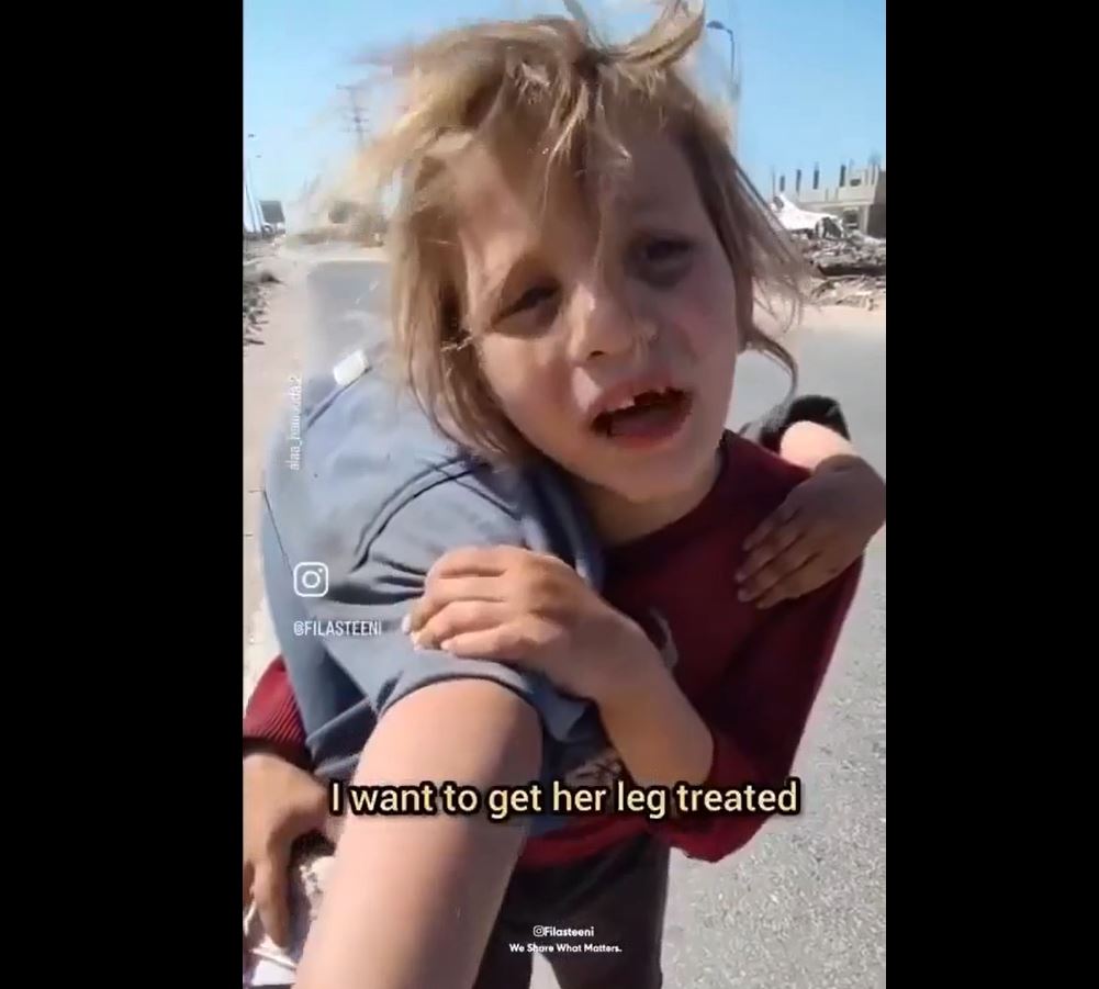 Video: Palestinian child girl struggles to carry her wounded sister to their makeshift tent in Gaza 
