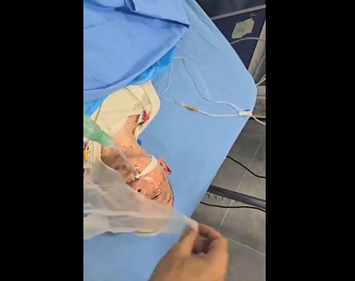 Video: Distressing scenes of injured Palestinian children in Gaza Kamal Adwan Hospital