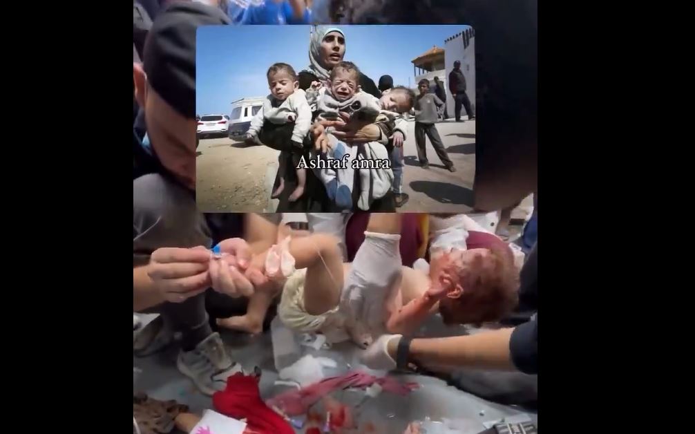 Video: Gaza infants under severe condition 