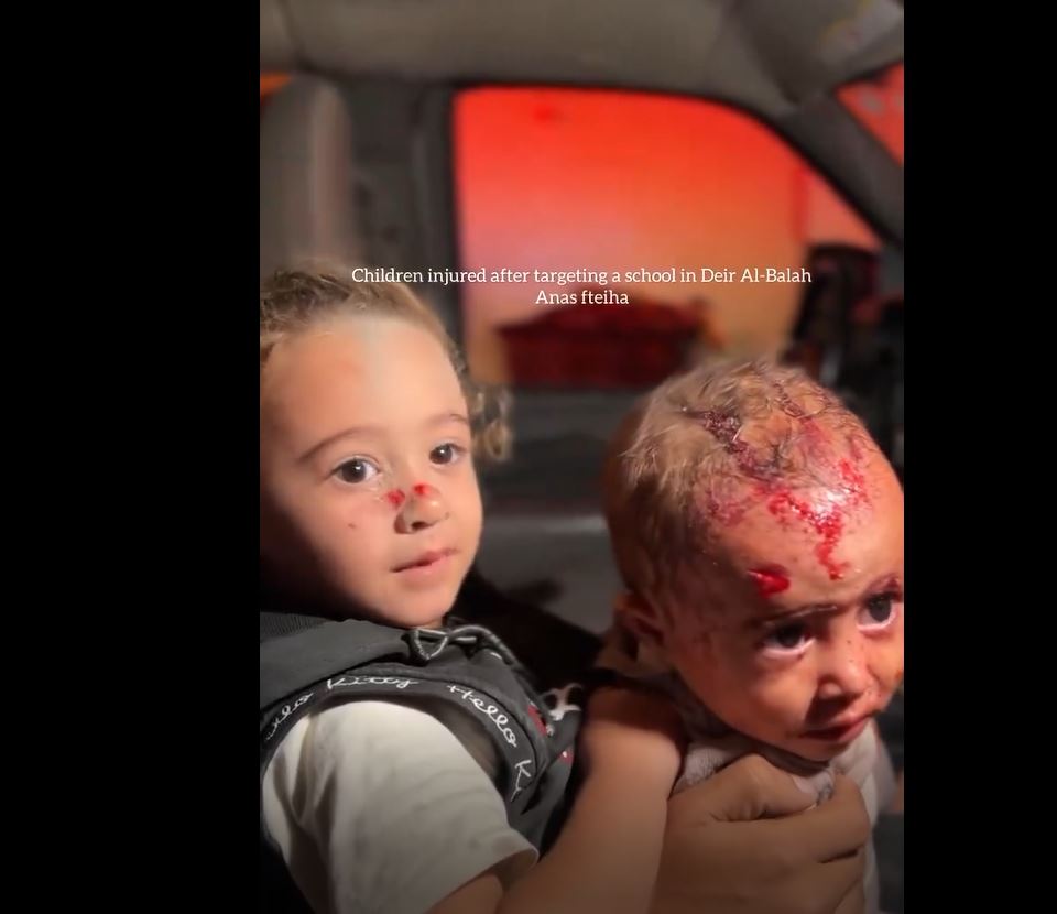Sensitive video: Children injured in Israeli air attacks on Deir al-Balah, Central Gaza Strip
