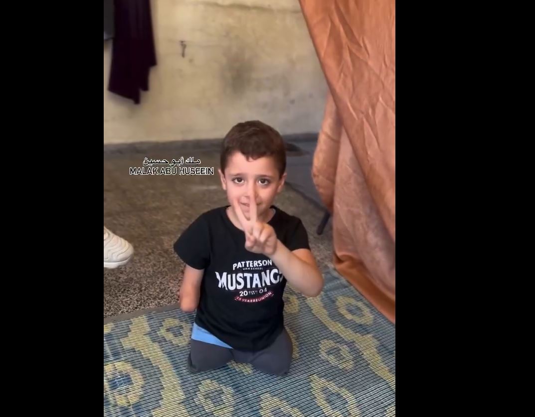 Video: Innocent Palestinian boy lost three limbs due Israel airstrikes in northern Gaza
