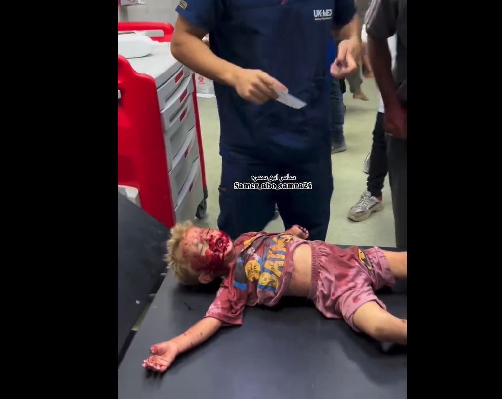 Sensitive Video: Gaza children still under bombarded of Zionist army