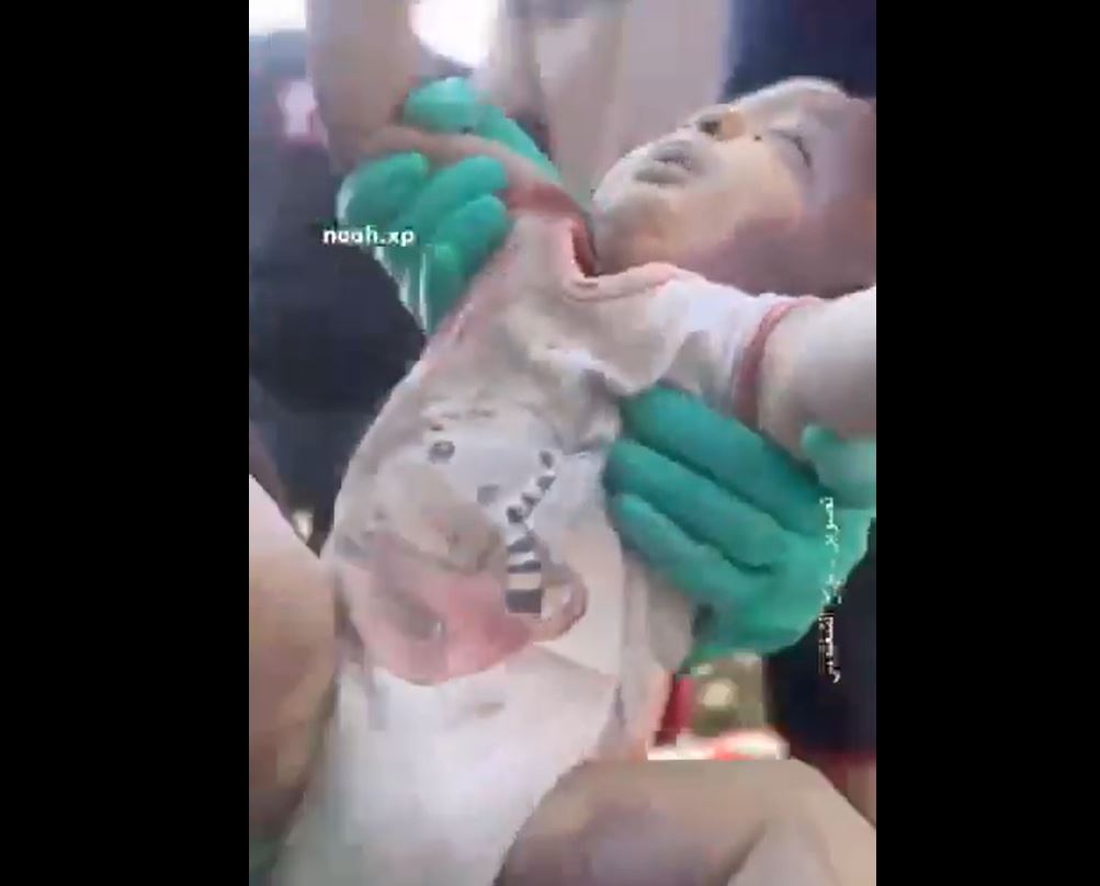 Sensitive: Palestinian Civil Defense Crews managed to retrieve body of an infant killed in Israeli airstrike in Gaza 