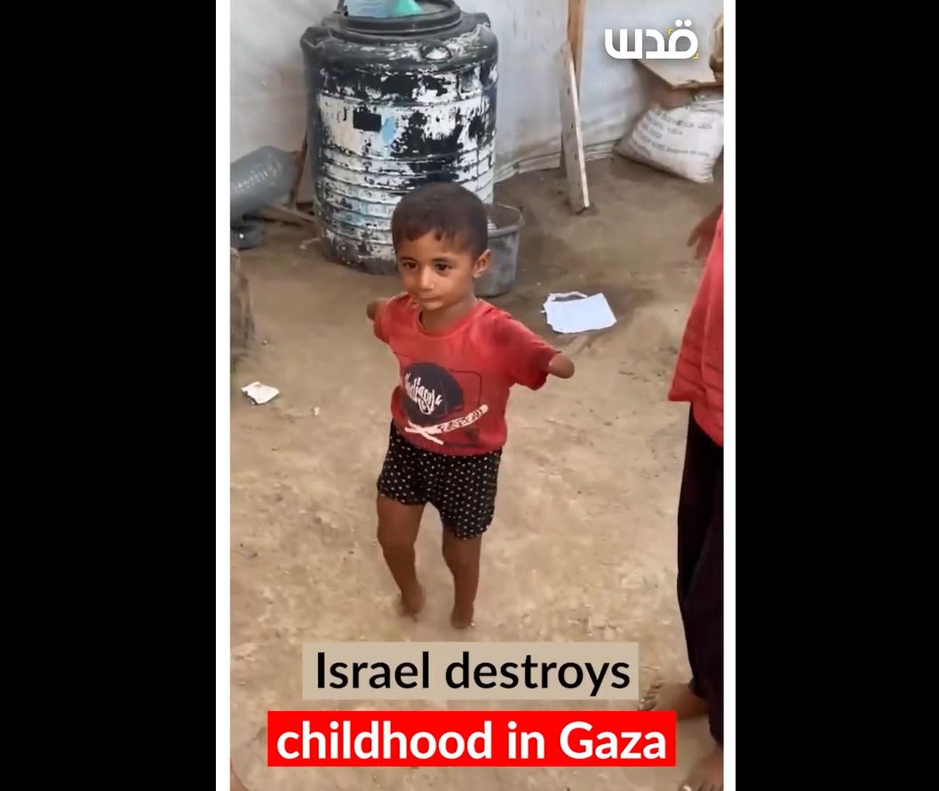 Video: A Palestinian boy with amputated limbs in Gaza joyfully plays with other children
